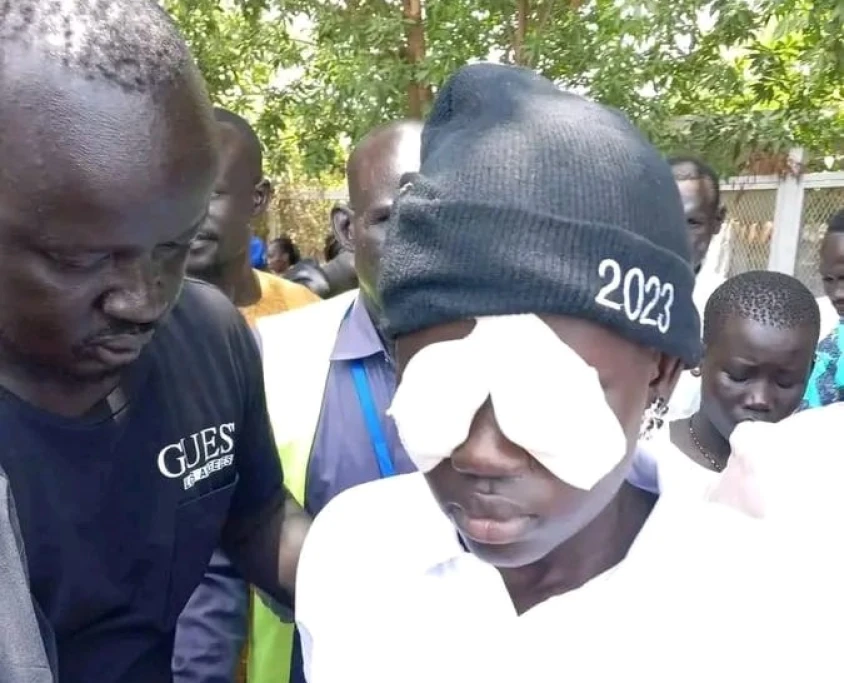 Akuot is in Juba for eye treatment