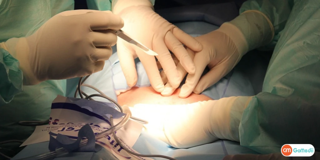 NBGS announces free fistula operations