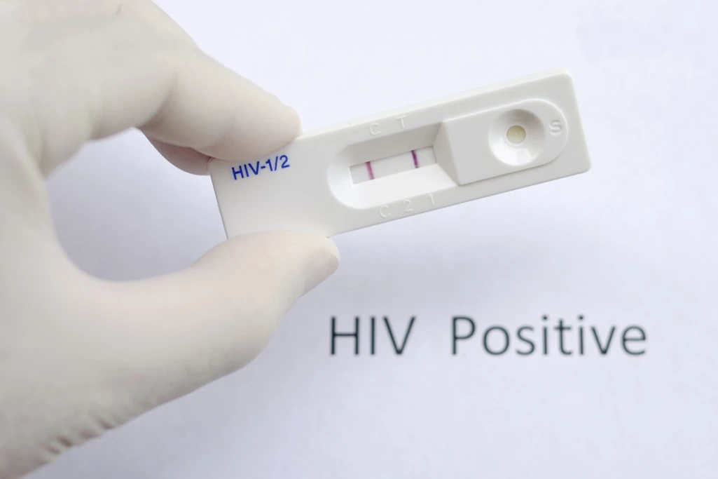 64 test positive for HIV in Awerial
