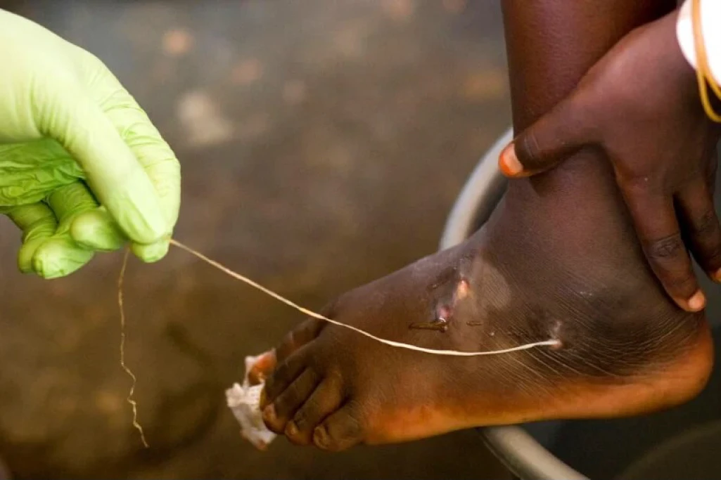 Carter Center rewards guinea worm survivors in Awerial