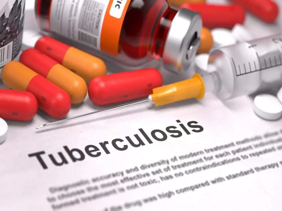 TB is not a genetic disease, Awerial told