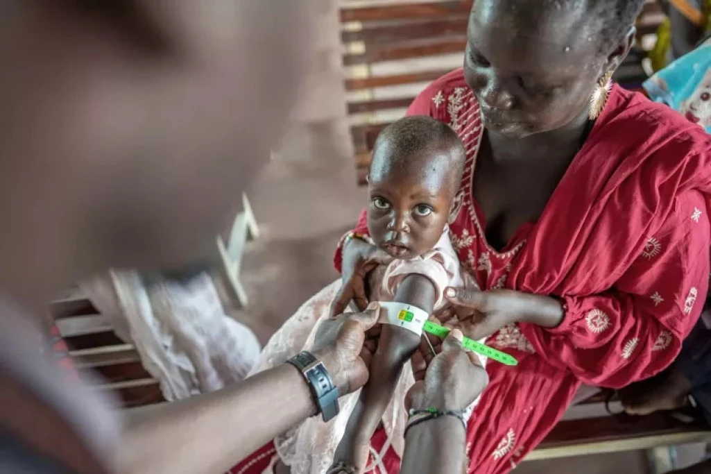 Malnutrition crisis deepens in South Sudan as children face high risk amid cholera outbreaks