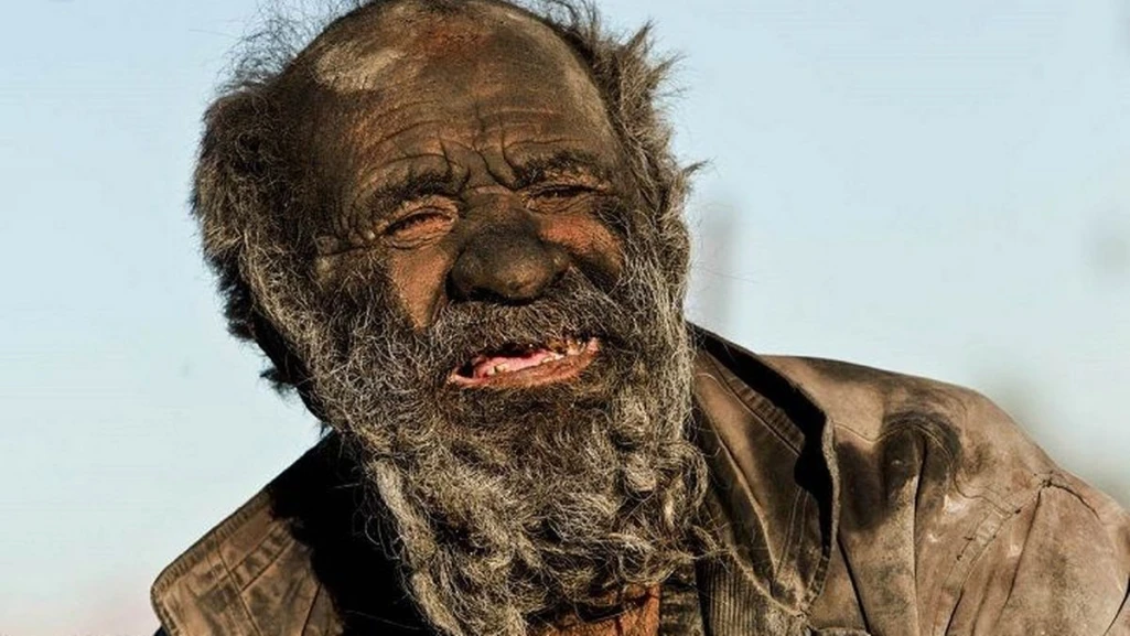 Dirtiest man in the world dies after bathing
